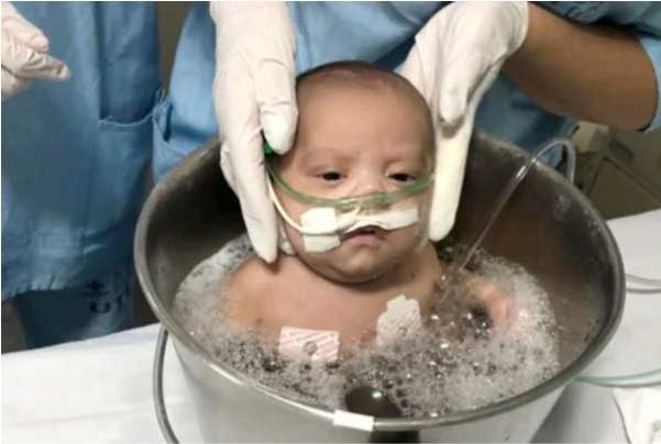 Bebês podem ficar no banho relaxante por até 10 minutos. - Foto: divulgação HB