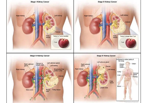 Imagem - Surinder M. Soond et al. - 10.3390/pharmaceutics13030339